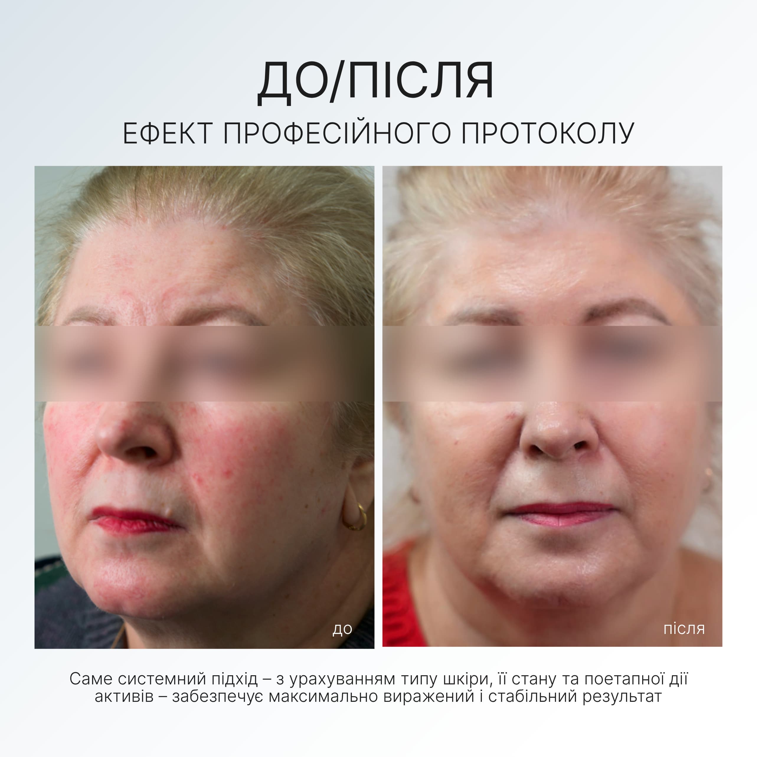 NOURISHING CREAM