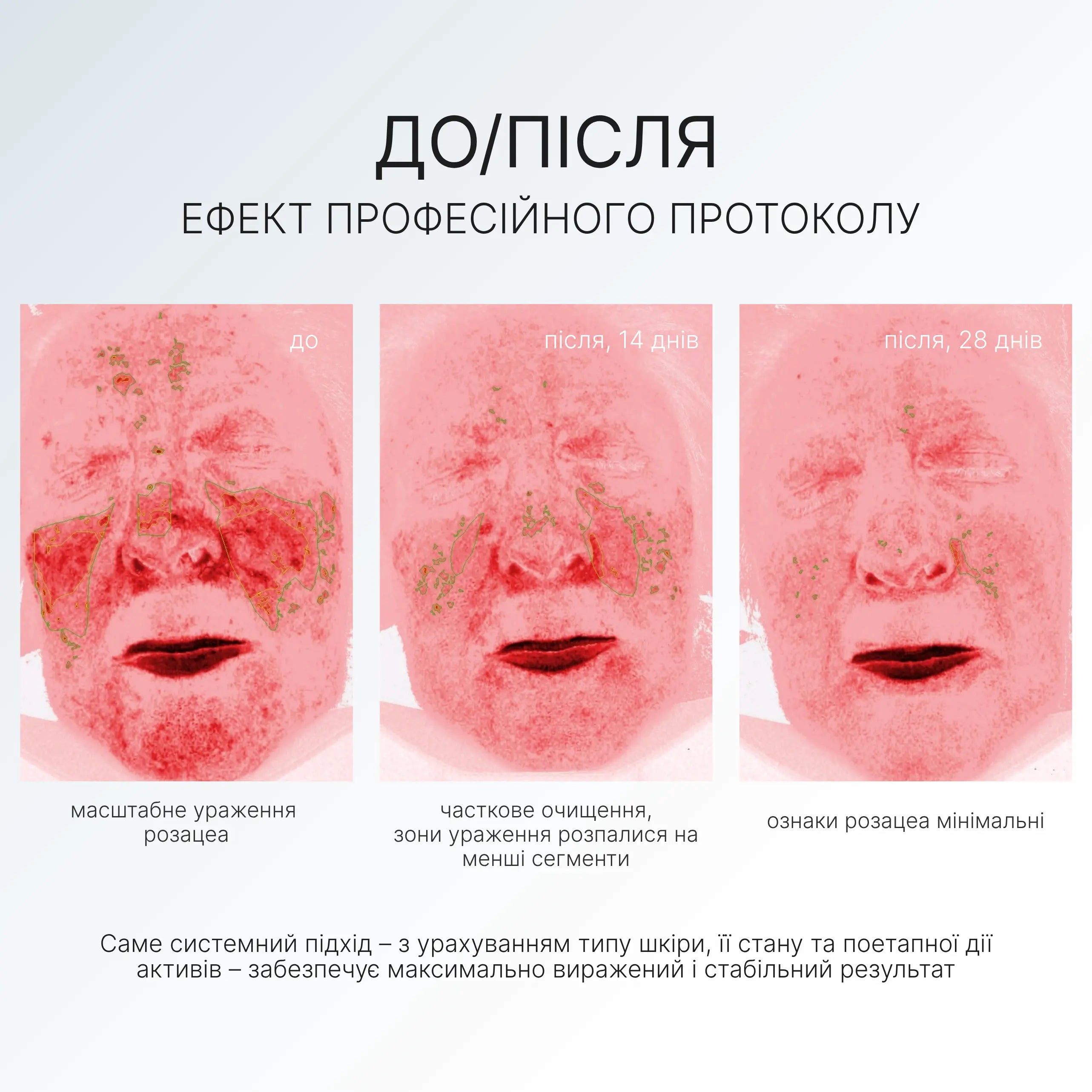 NOURISHING CREAM