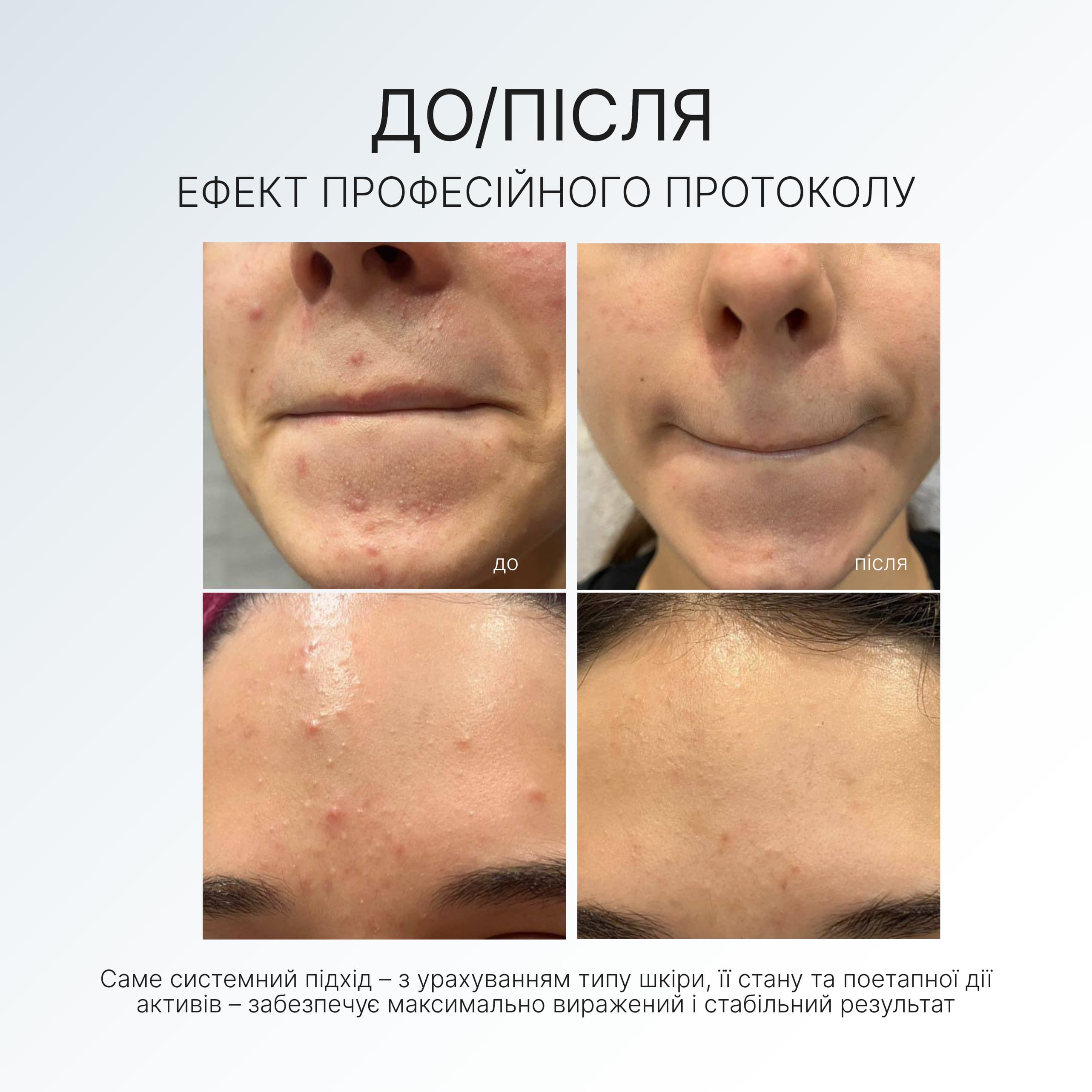 GEL СRЕАМ