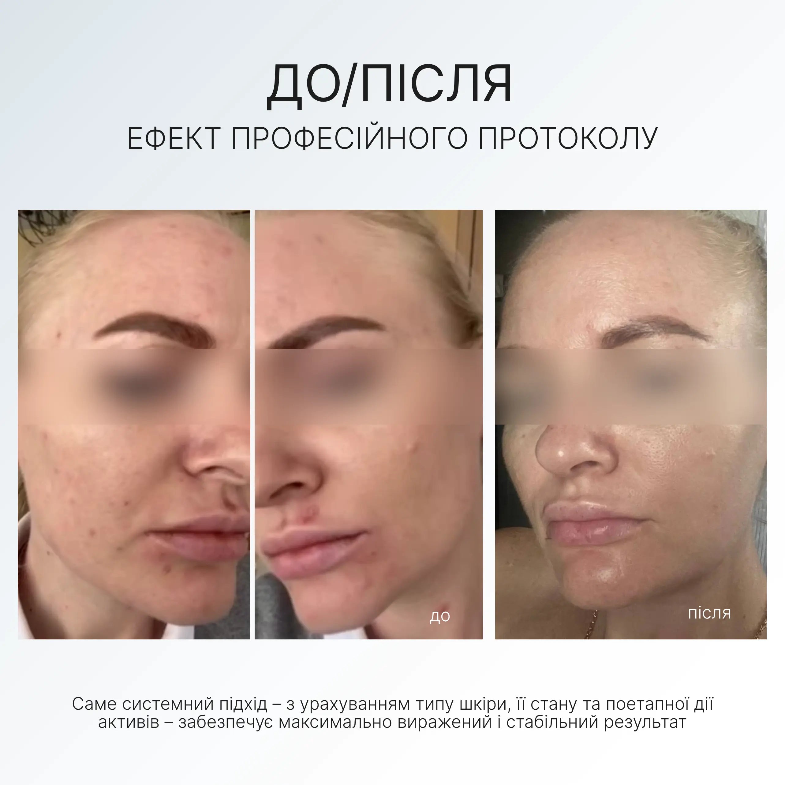 MOISTURIZING CREAM