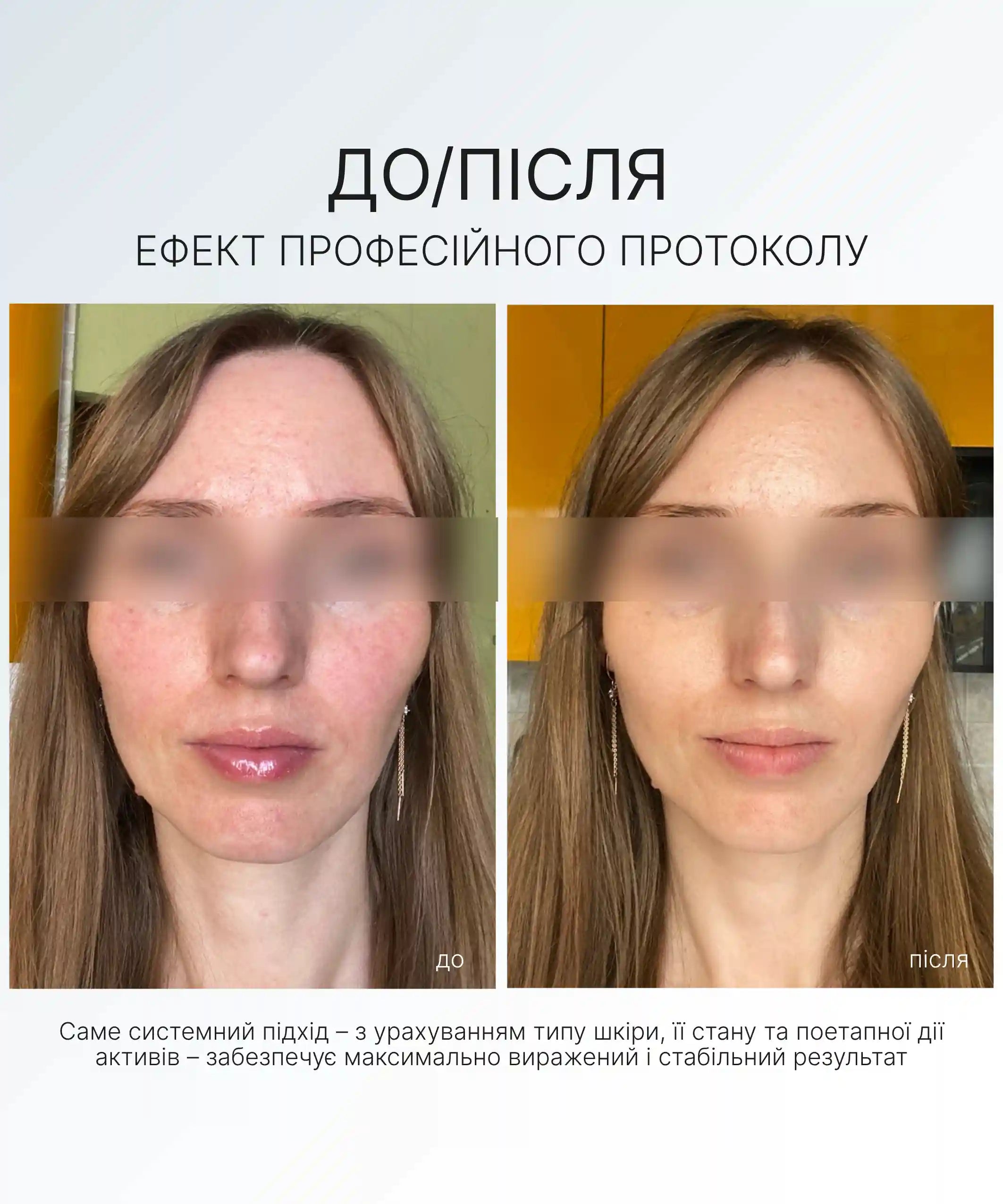 НАБІР ЕНЕРГІЯ ВІТАМІНУ С AG SKIN
