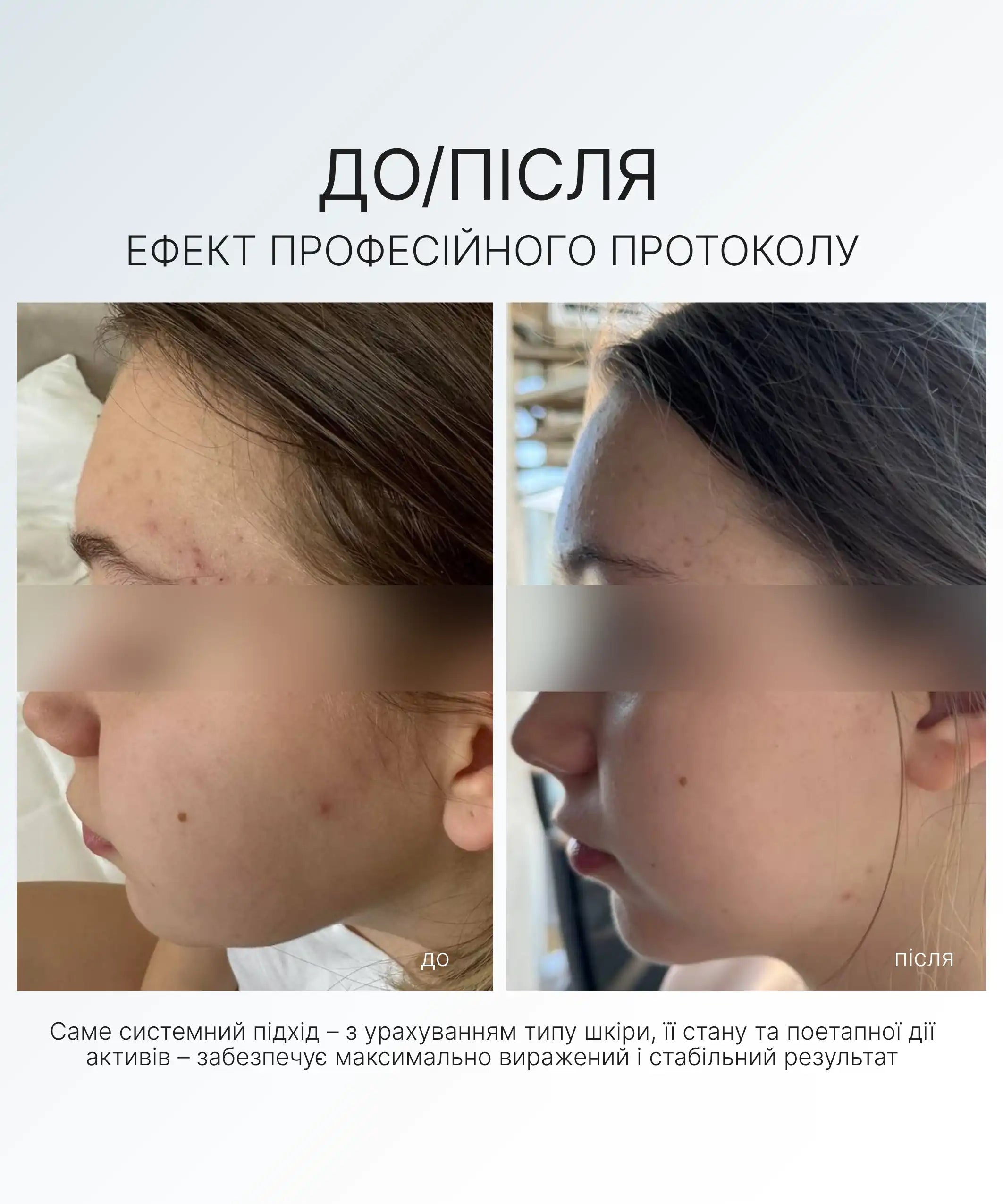 НАБІР ДЛЯ ГЛИБОКОГО ОЧИЩЕННЯ AG SKIN