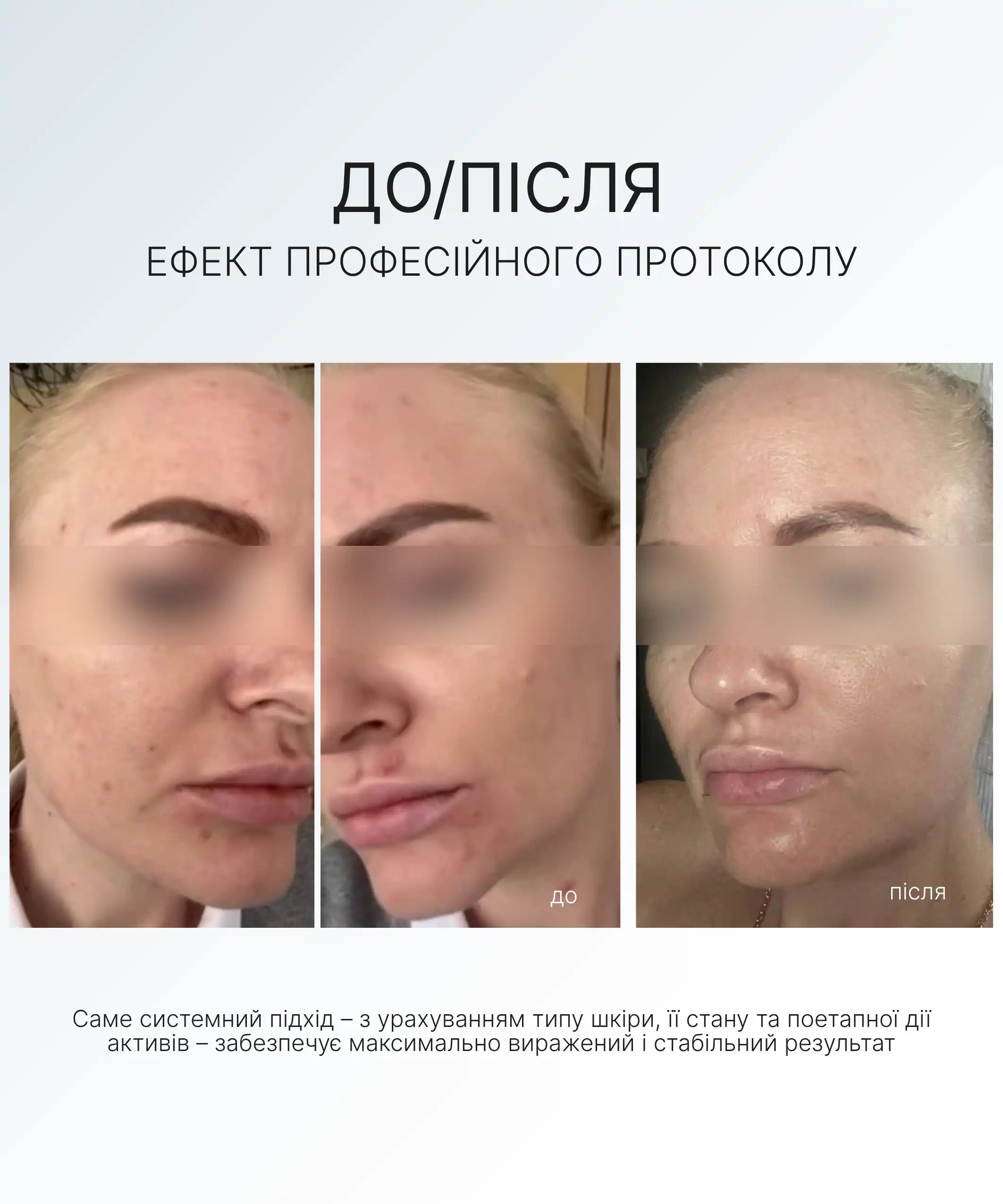 НАБІР ДЛЯ ЗВОЛОЖЕННЯ ТА ВІДНОВЛЕННЯ МІКРОБІОМУ ШКІРИ AG SKIN