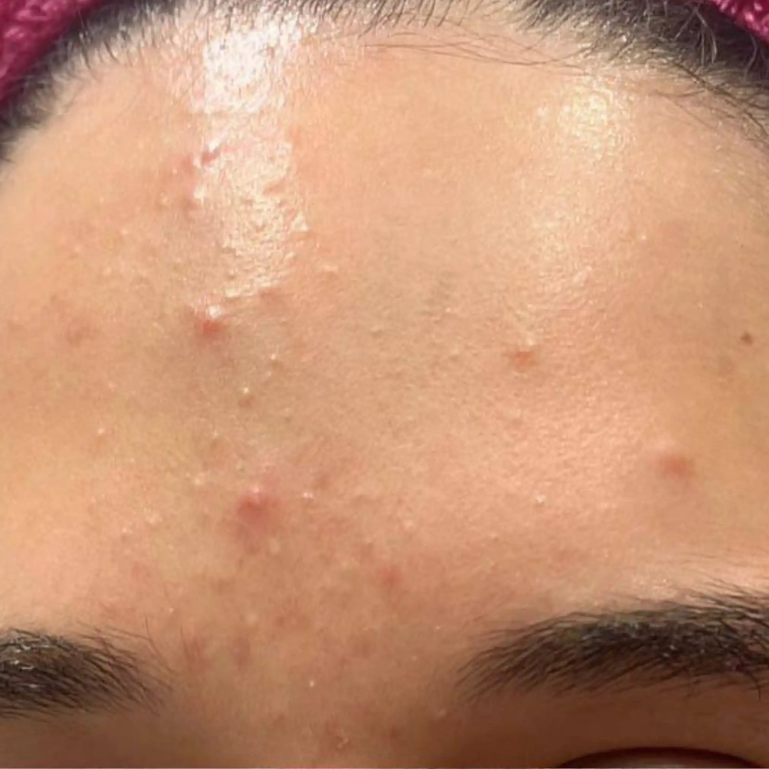 image comparison before