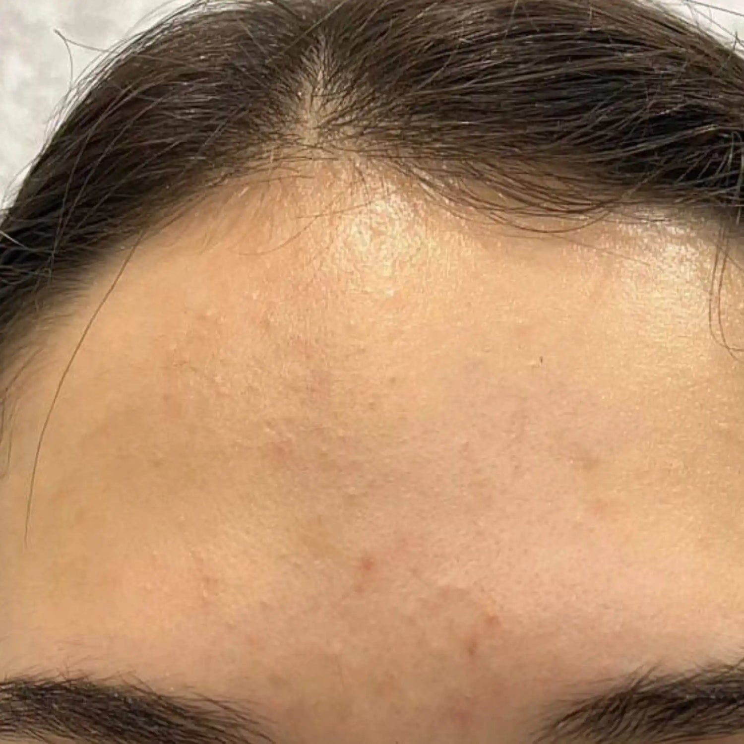 image comparison after