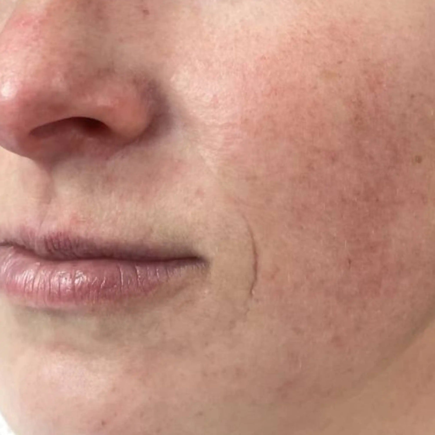 image comparison after