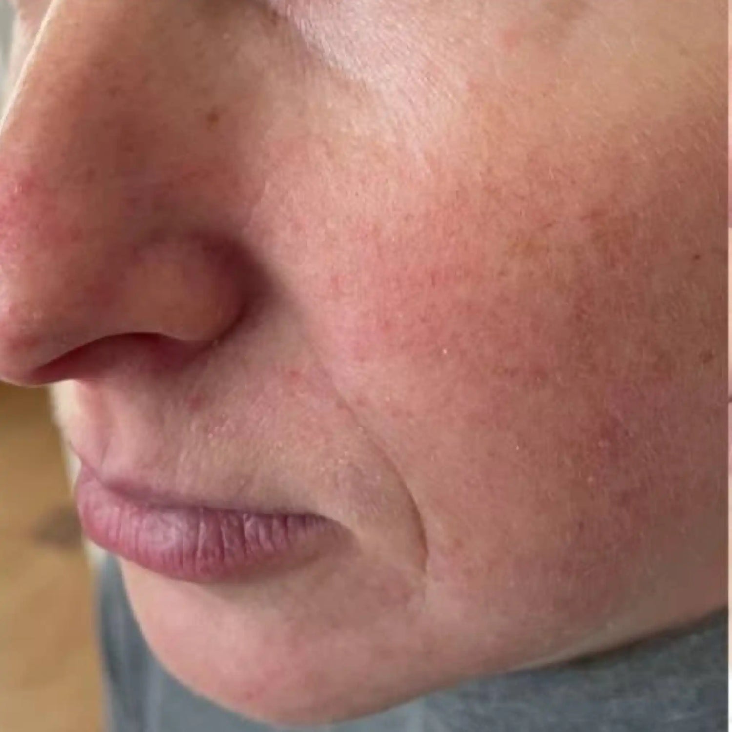 image comparison before