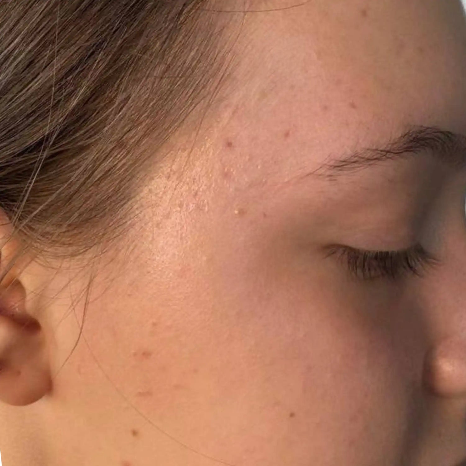 image comparison after