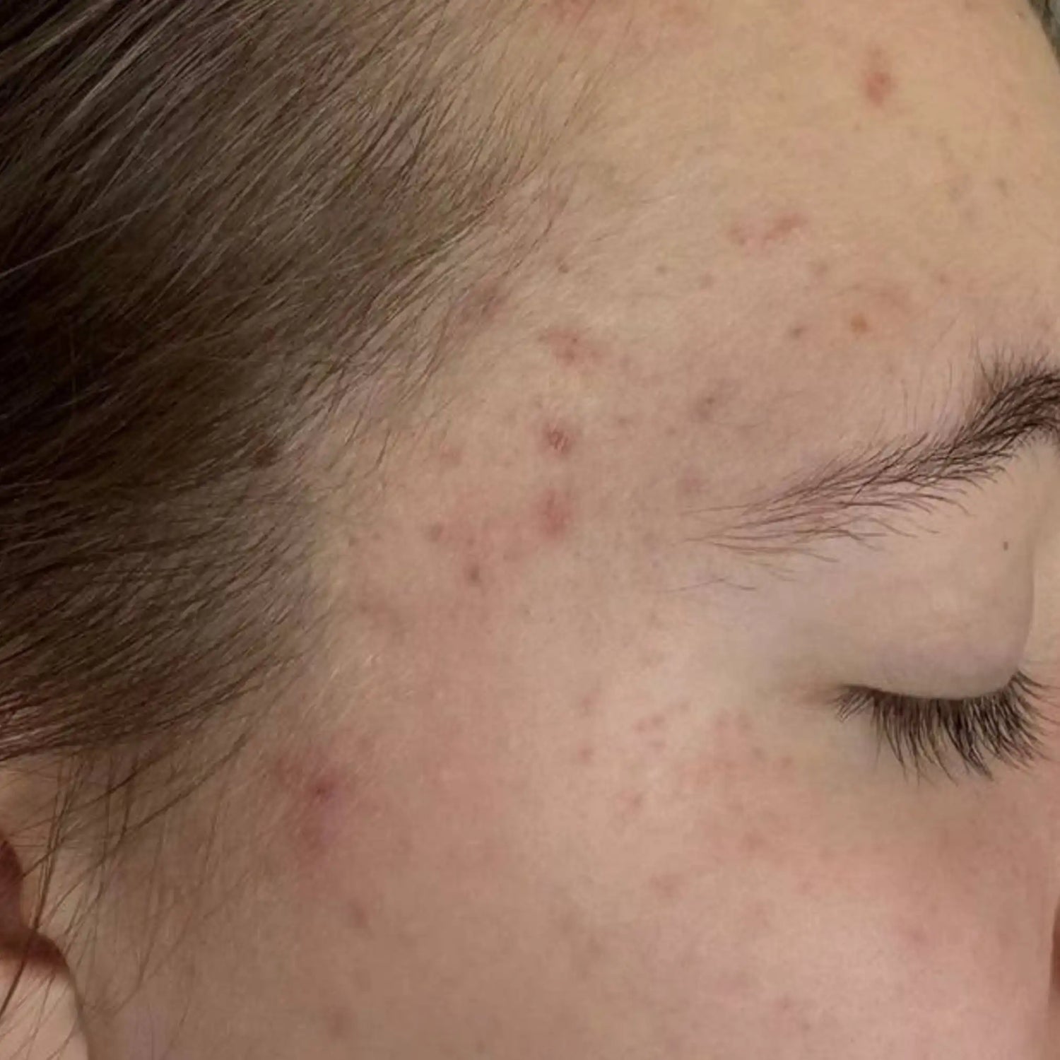 image comparison before