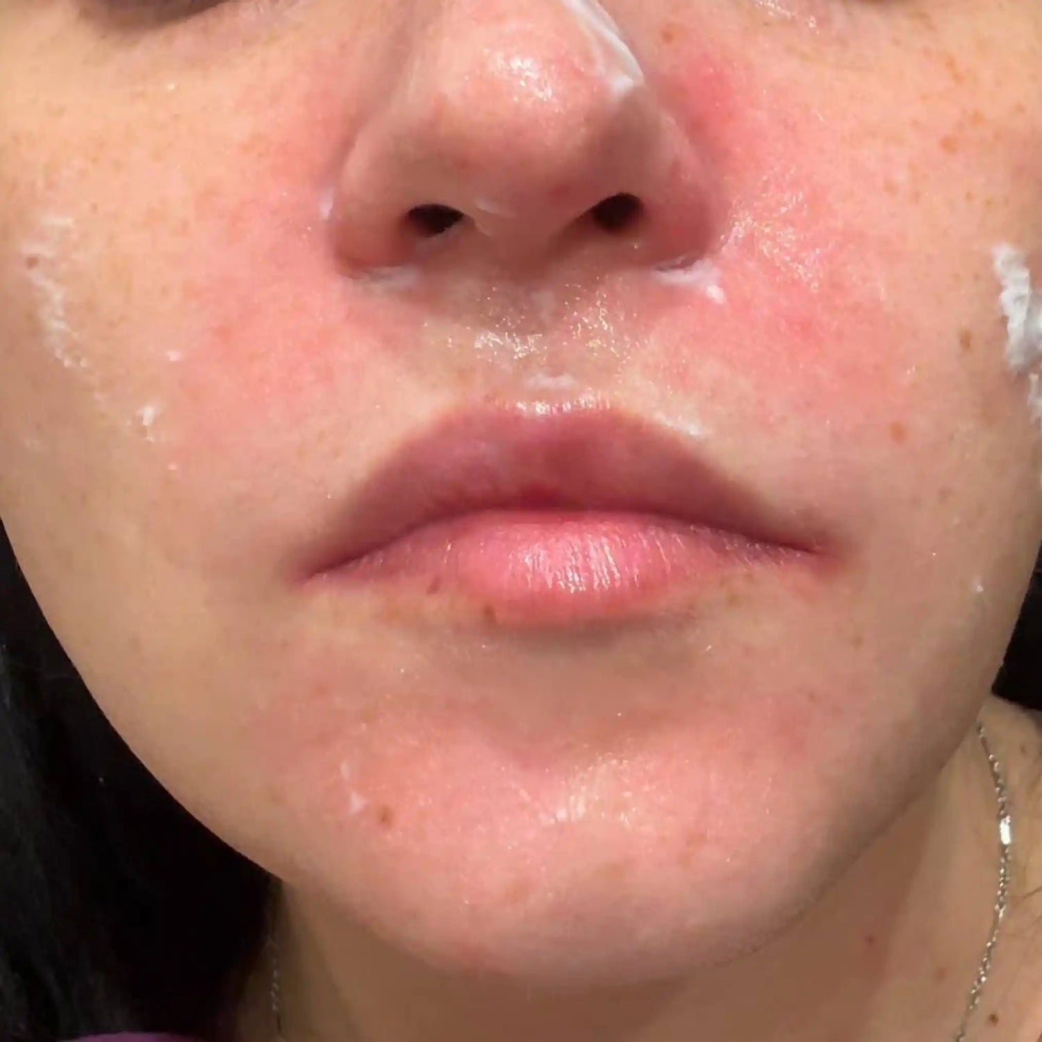 image comparison after