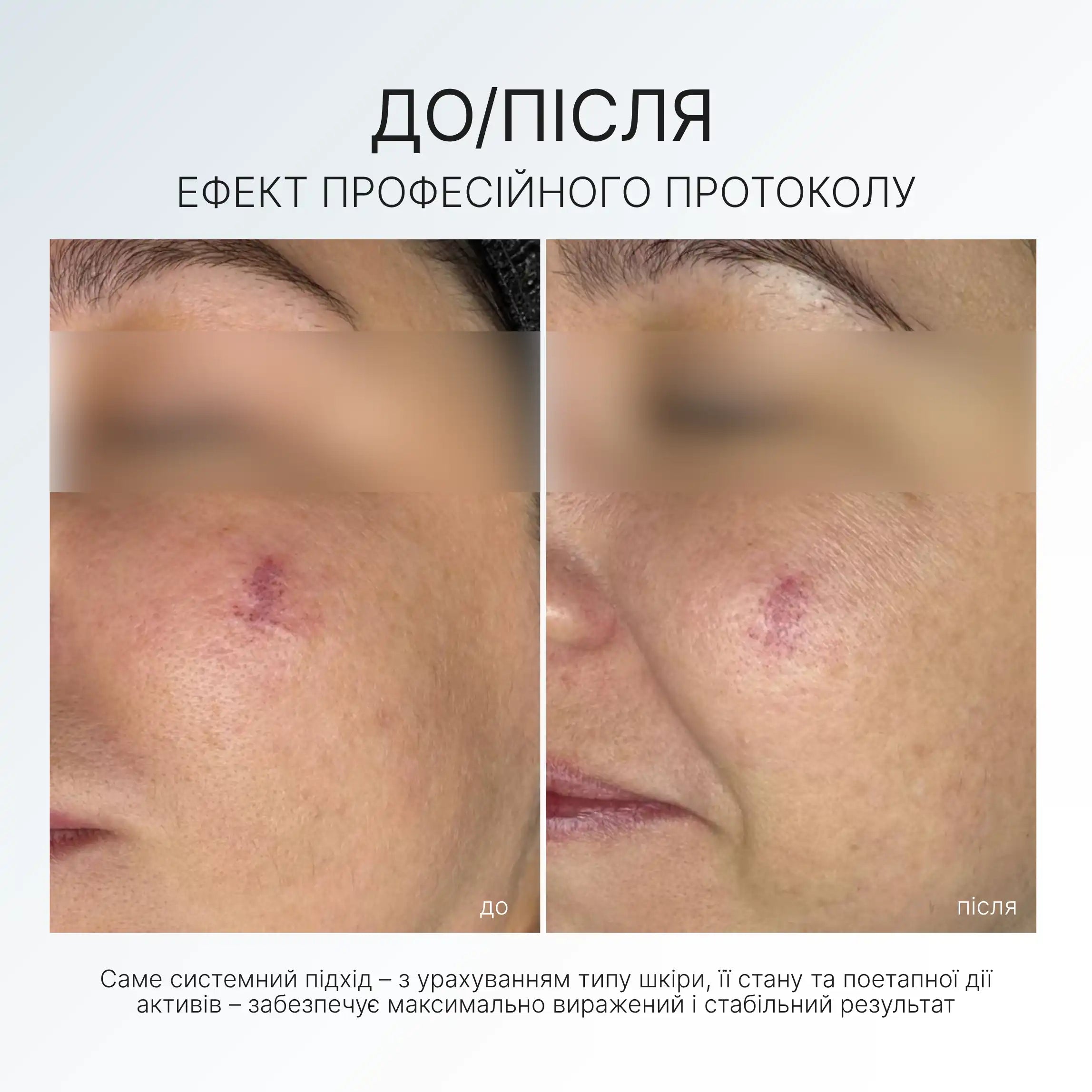 ANTI-REDNESS SERUM